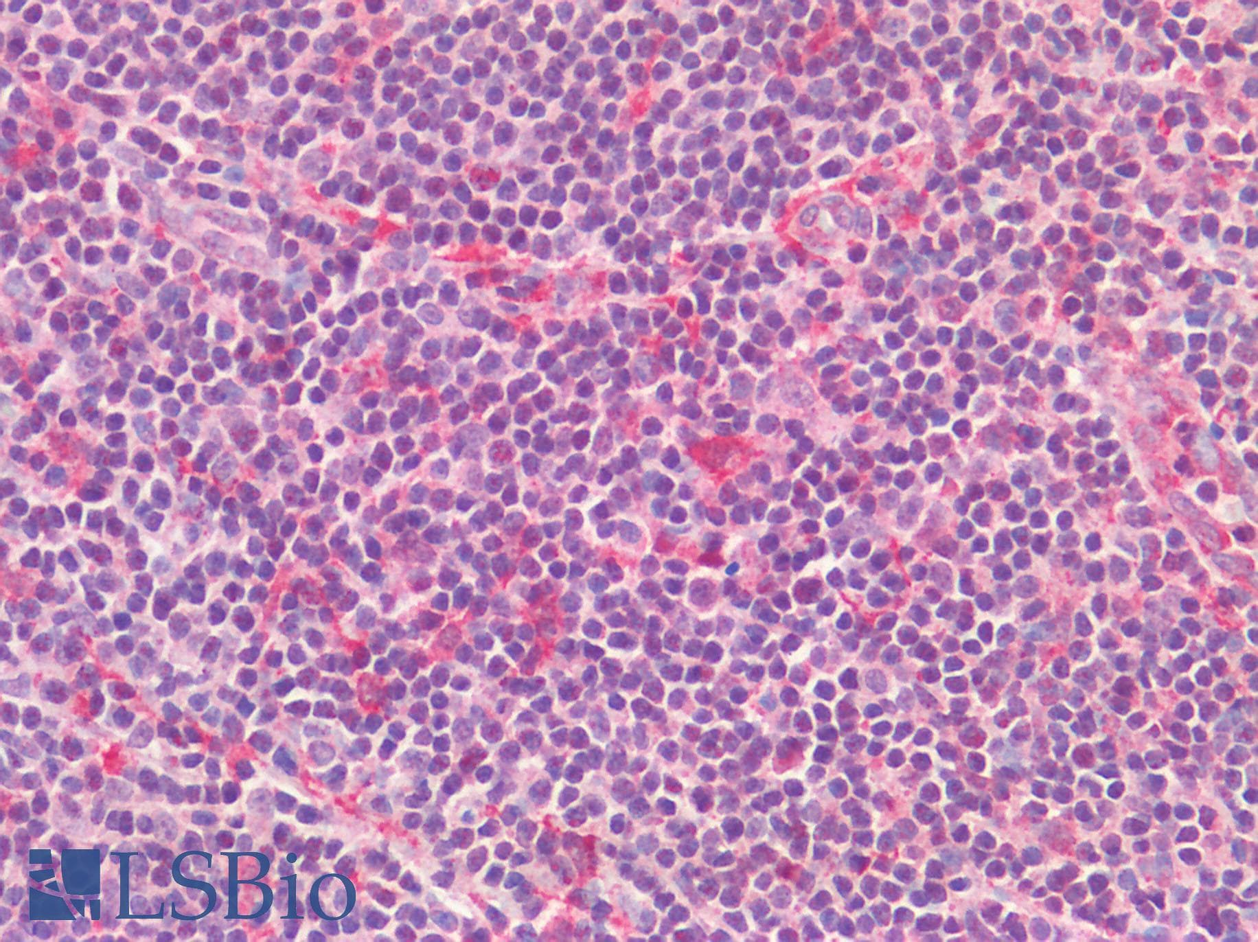 IHC-plus™ AIF1 / IBA1 Antibody (C-Terminus)