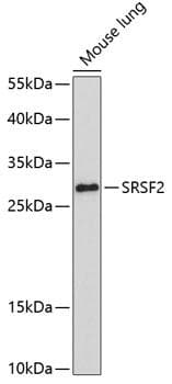 SRSF2 / SC35 Antibody