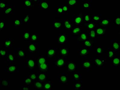 HIST1H2BN Antibody
