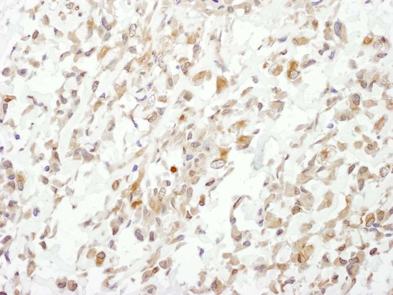 Polyclonal Rabbit anti-Human CUL1 / Cullin 1 Antibody (aa250-300, IHC)