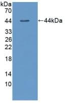 TSHB / TSH-Beta Antibody (aa20-138, PE)