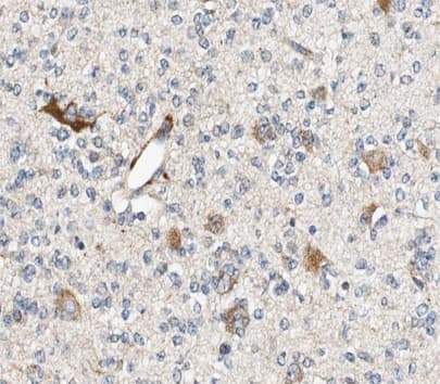 ALDOC / Aldolase C Antibody