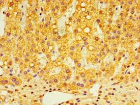 GPS1 / CSN1 Antibody (aa222-491)