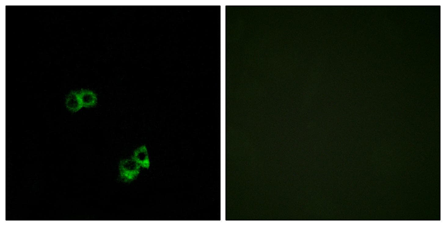 MC5R / MC5 Receptor Antibody