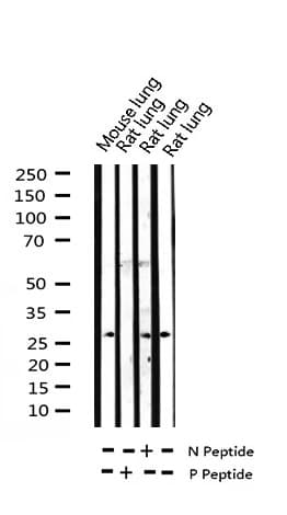 Polyclonal Rabbit anti-Human TK1 / TK / Thymidine Kinase Antibody (phospho-Ser13, IHC, IF, WB)