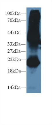 GREM1 / Gremlin-1 Antibody (aa26-184, Cy3)