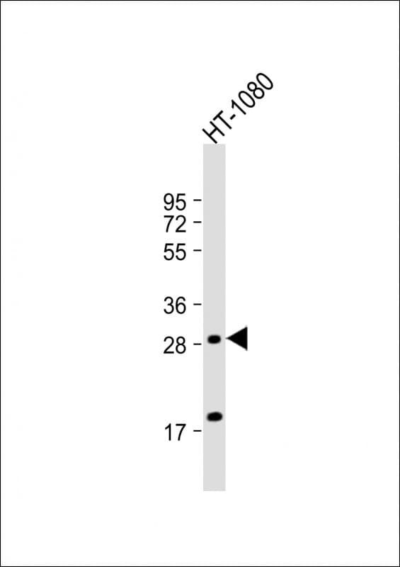 FP / PTGFR Antibody (aa169-199)