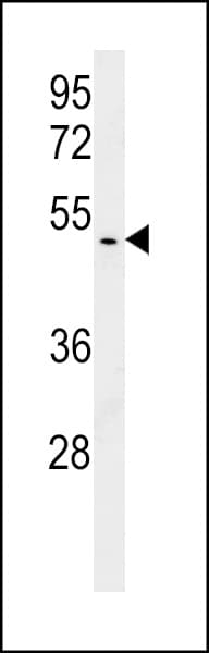 Polyclonal Rabbit anti-Human BABAM1 / HSPC142 Antibody (aa9-37, IHC, WB)