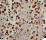 HHV-8 / HHV8 / KSHV Antibody (clone 13B10)