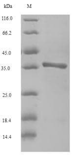 Horse Major allergen Equ c 1 Protein (Recombinant 6His-SUMO, N-terminus)