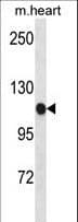 Polyclonal Rabbit anti-Mouse SCYL2 Antibody (aa585-613, WB)