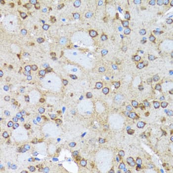 Polyclonal Rabbit anti-Human ACTR2 / ARP2 Antibody (IHC, IF, WB)