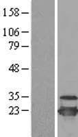 UBCH10 / UBE2C Protein (Over-Expression Lysate Myc-DDK (Flag))