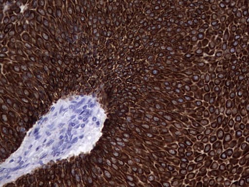 KRT19 / CK19 / Cytokeratin 19 Antibody (aa240-390, clone OTI3D10)