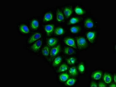 SLC6A13 / GAT-2 Antibody