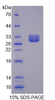 Human GOB5 / CLCA1 Protein (Recombinant His)