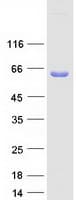 Human PDI / P4HB Protein (Recombinant Myc-DDK (Flag))