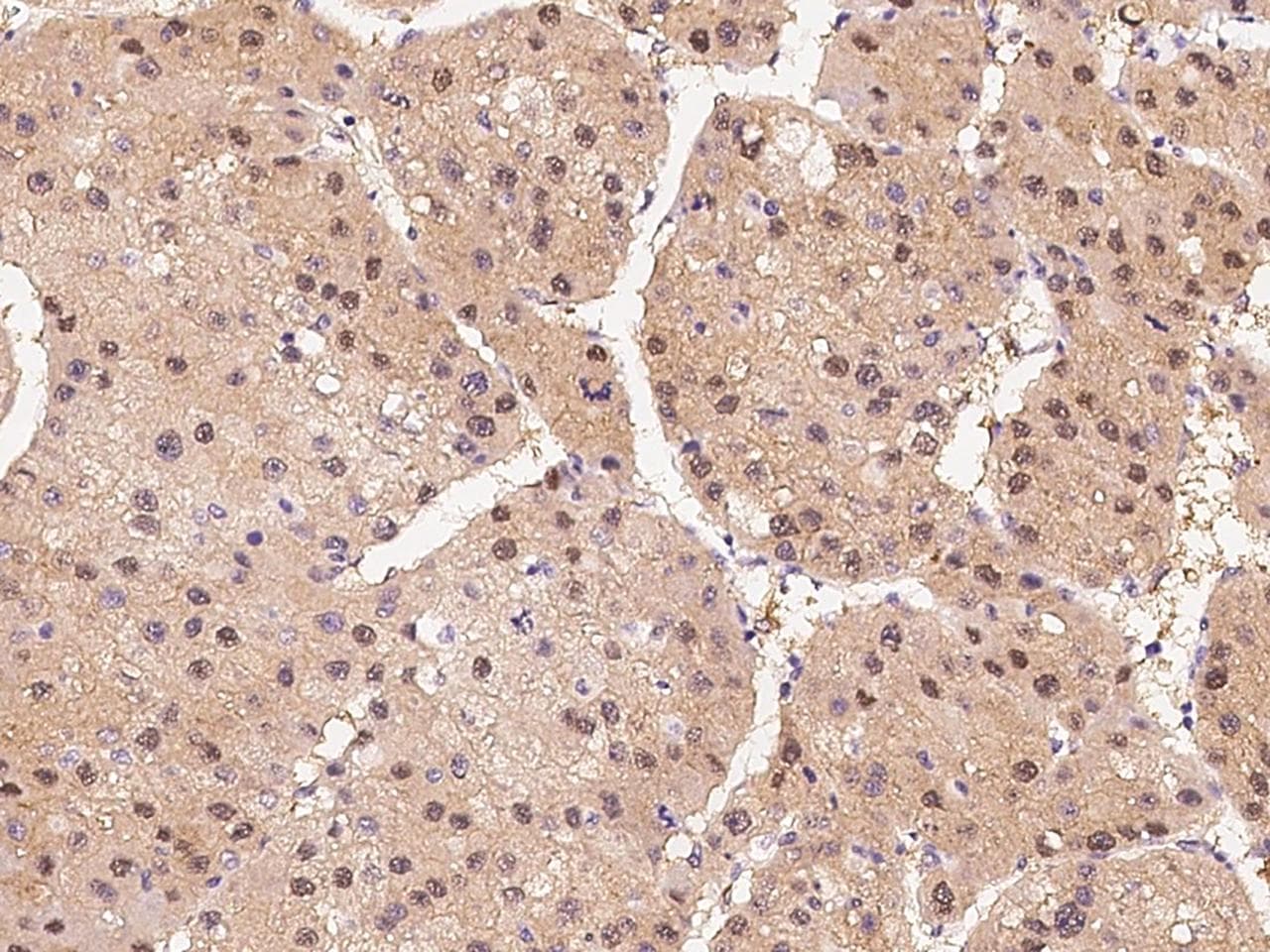 Polyclonal Rabbit anti-Human HIPK2 Antibody (IHC)
