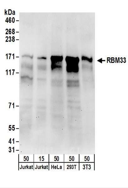 Polyclonal Rabbit anti-Human RBM33 Antibody (aa150-200, WB)