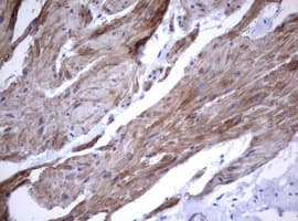Monoclonal Mouse anti-Human CD30 Antibody (clone OTI9H7, IHC, WB)