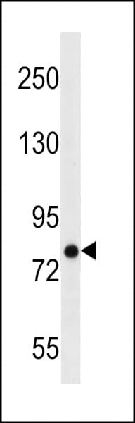 ARHGEF4 Antibody (aa573-599)