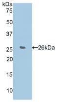 CCN5 Antibody (aa24-250)