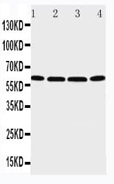 P2RX6 / P2X6 Antibody (aa387-406)