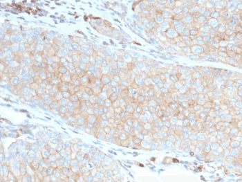 Monoclonal Mouse anti-Human CD274 / B7-H1 / PD-L1 Antibody (clone PDL1/2746, IHC, IF, WB)