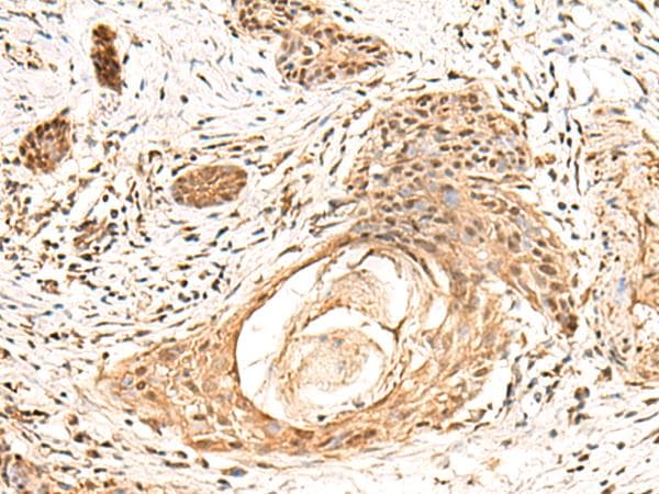 KCTD13 Antibody