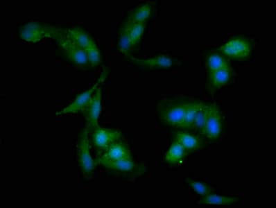 WDFY3 / ALFY Antibody