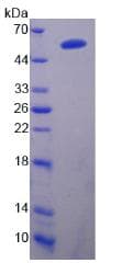 Rat PCSK9 Protein (Recombinant His-GST, N-terminus)