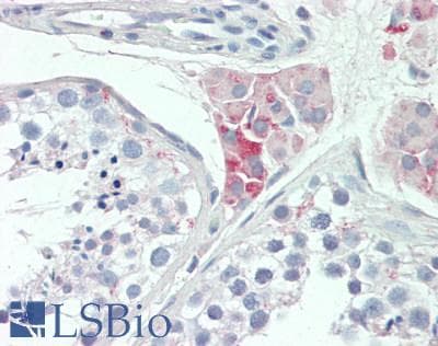 IHC-plus™ Polyclonal Rabbit anti-Human CDH24 / EY Cadherin Antibody (50-130 aa, N-terminal, IHC, IF)