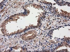 DSTN / Destrin Antibody (clone OTI2F7)