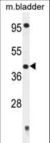 SLFNL1 Antibody (aa62-91)