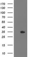 HDHD2 Antibody (clone OTI2E9)