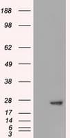Monoclonal Mouse anti-Human AK1 / Adenylate Kinase 1 Antibody (clone OTI19G4, WB)