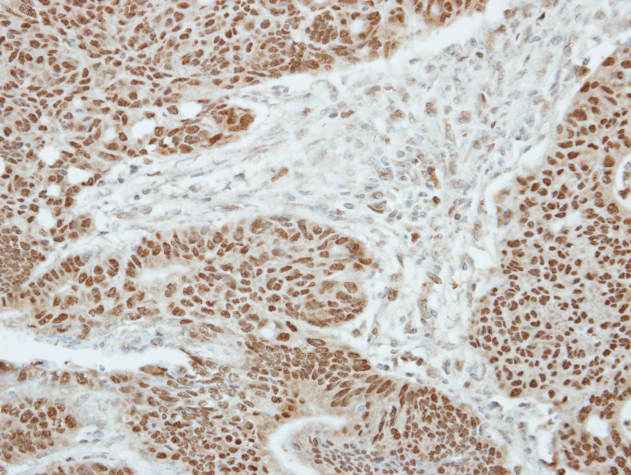 ZBTB9 Antibody
