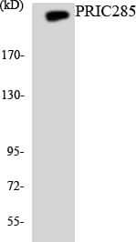 Polyclonal Rabbit anti-Human HELZ2 / PRIC285 Antibody (aa1892-1941, WB)