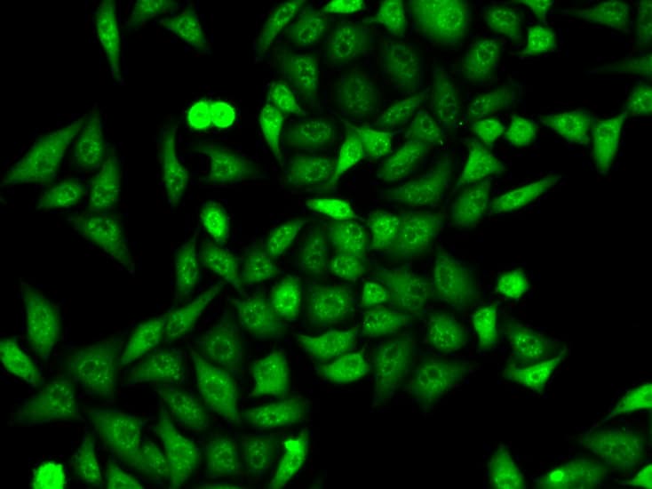 Polyclonal Rabbit anti-Human ANXA6/Annexin A6/Annexin VI Antibody (IHC, IF, WB)