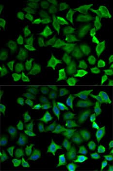 NOS1 / nNOS Antibody
