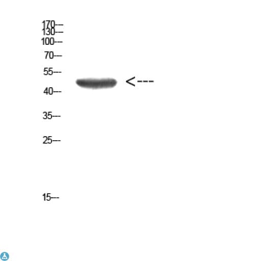 Polyclonal Rabbit anti-Human KRT14 / CK14 / Cytokeratin 14 Antibody (WB)