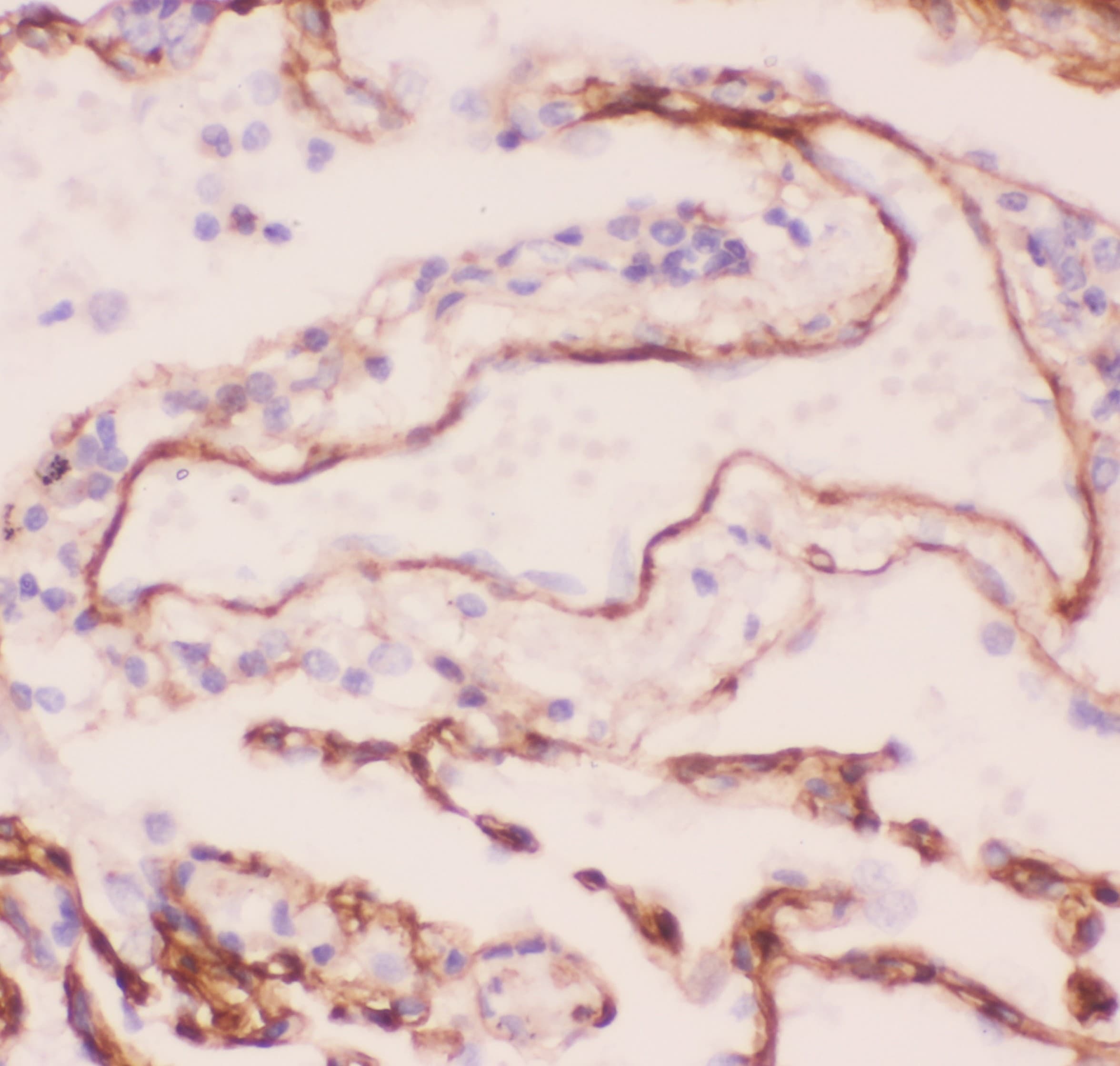COL4A1 / Collagen IV Alpha1 Antibody (aa1445-1669)