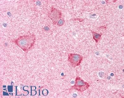 IHC-plus™ HIAT1 Antibody (aa454-483)