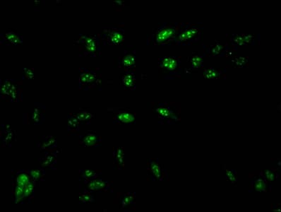 HIST1H1E Antibody