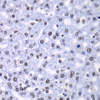 Polyclonal Rabbit anti-Human SF3B2 Antibody (IHC, IF, WB)