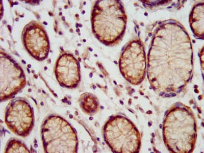 MEIS3 Antibody