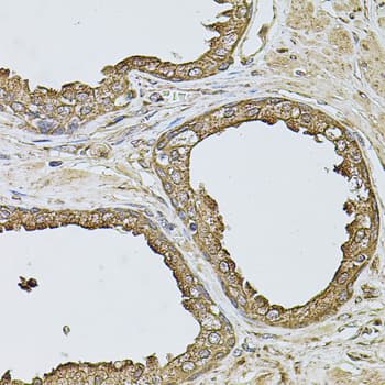 ANXA8L1 Antibody