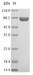 Human ME3 Protein (Recombinant 6His, N-terminus)