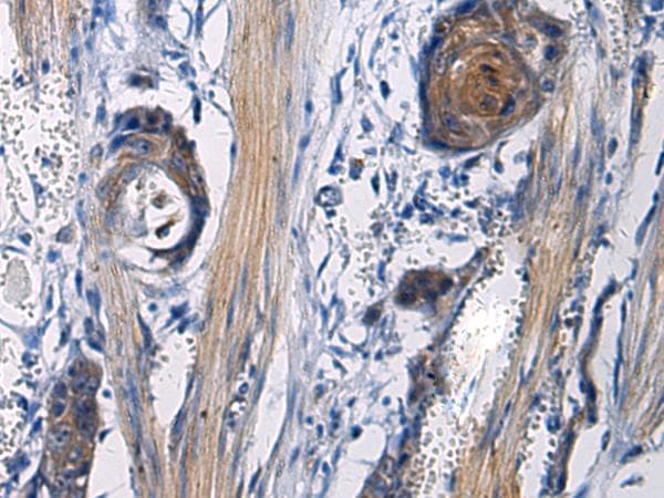 ICA69 / ICA1 Antibody