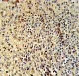 SPATA13 Antibody (aa204-232)